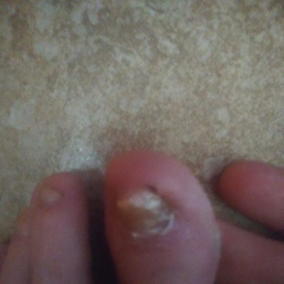 Meet your Posher, Lehman - Picture 1 of 1